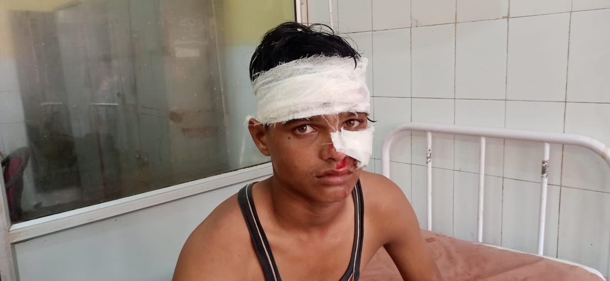 Hathras: Bikes collided near dirty drain, four people including girl injured