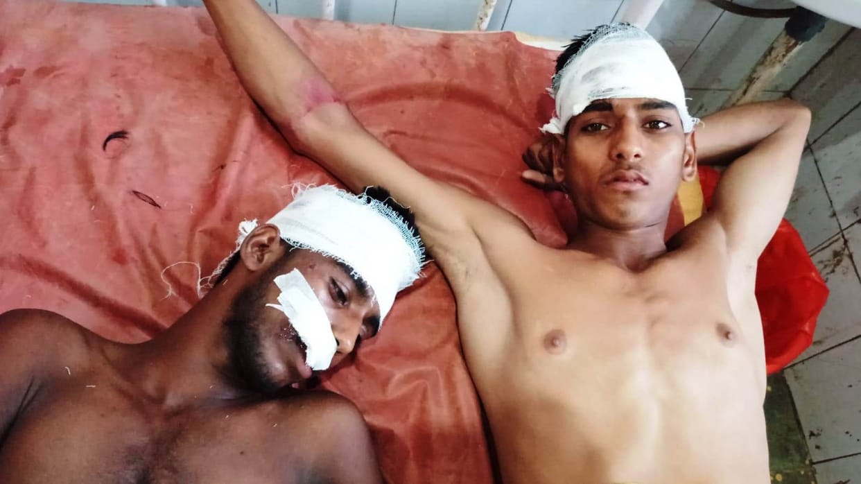 Hathras: Five people including couple injured in road accidents