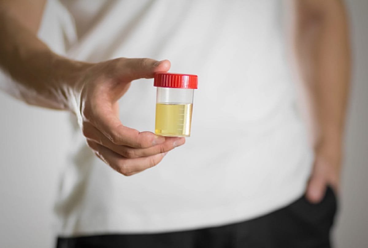 Identify the disease by changing color of urine it can be dangerous to ignore