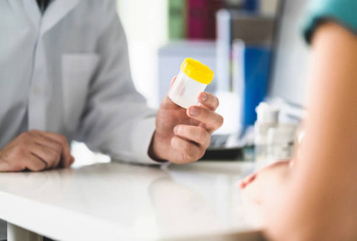 Identify the disease by changing color of urine it can be dangerous to ignore