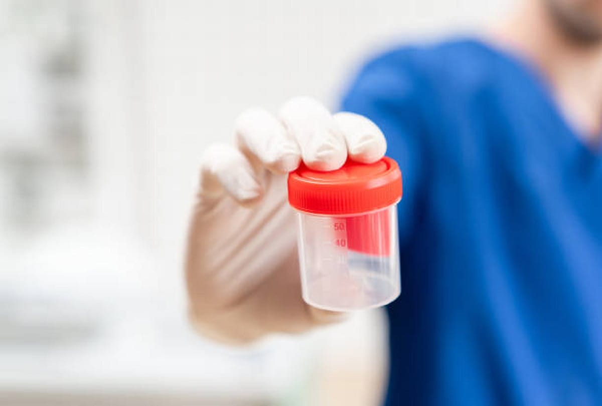 Identify the disease by changing color of urine it can be dangerous to ignore