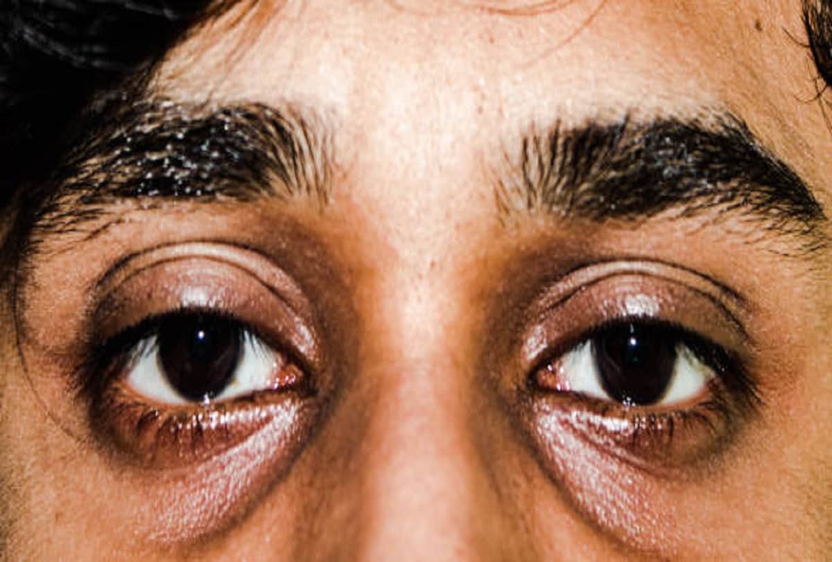 Type 2 Diabetes Symptoms in hindi do not ignore these signs