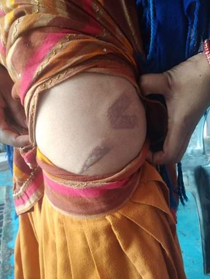 Hit the body of the married woman with a hot knife, then took her out of the house