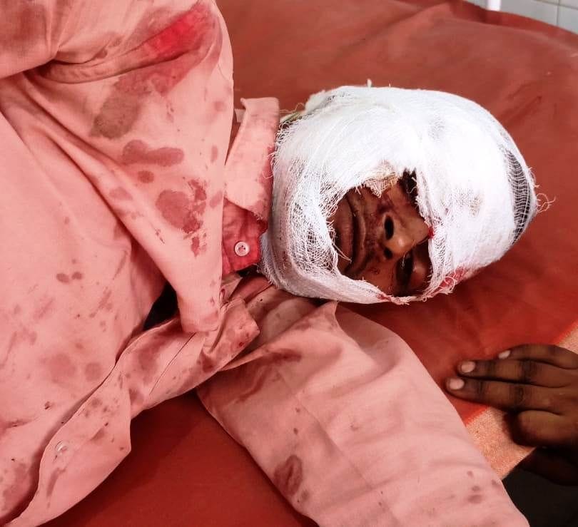 Hathras: Roadways bus hit Magic, three people injured