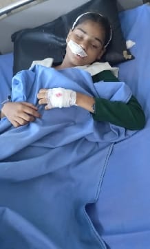 The girl student fell on her face due to the collision of the auto, two teeth were broken