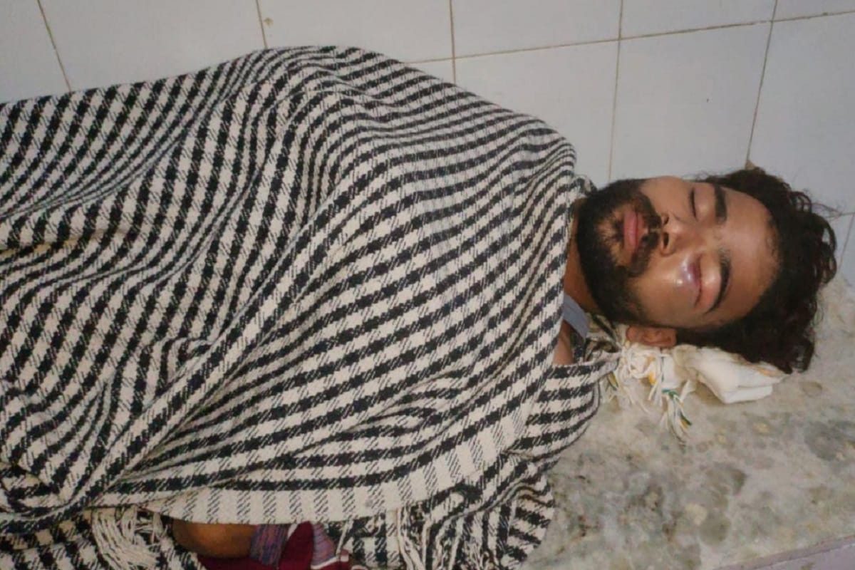 Saharanpur News: Smackies attacked a young man for dispute of money