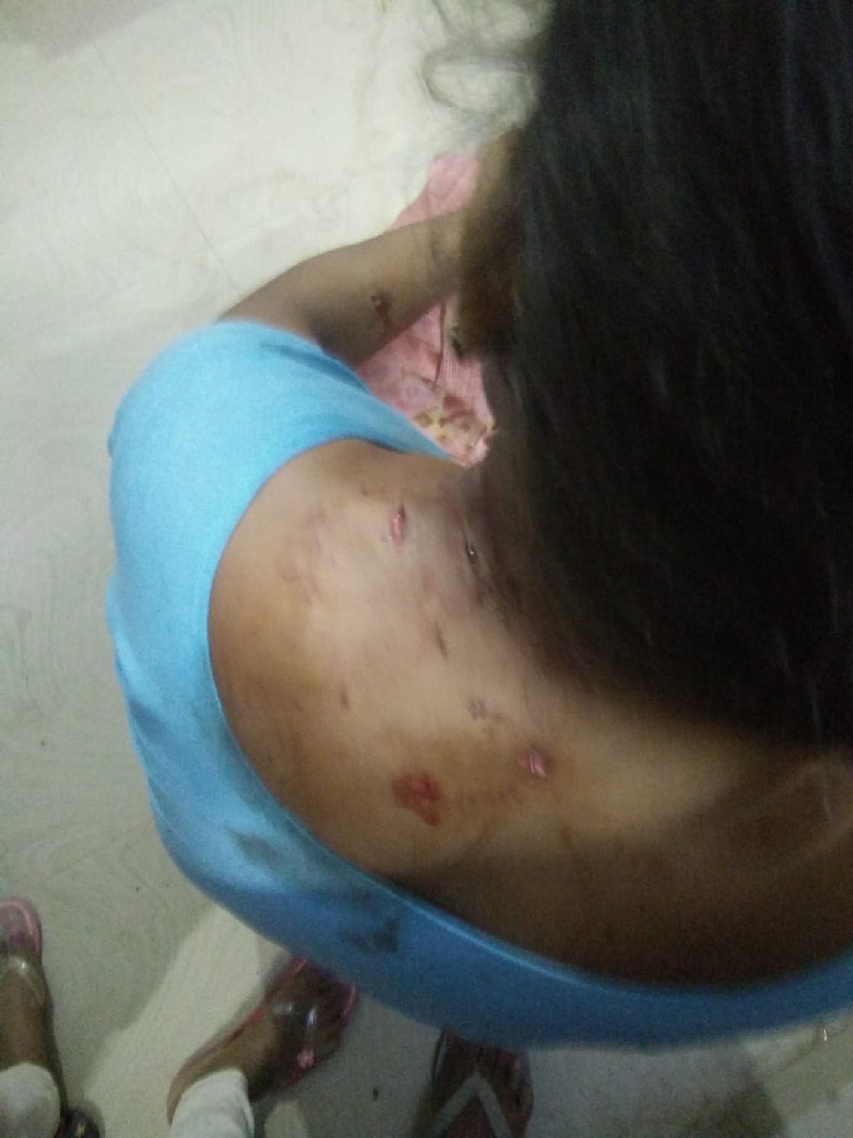 Leopard attack on woman guarding farm, serious