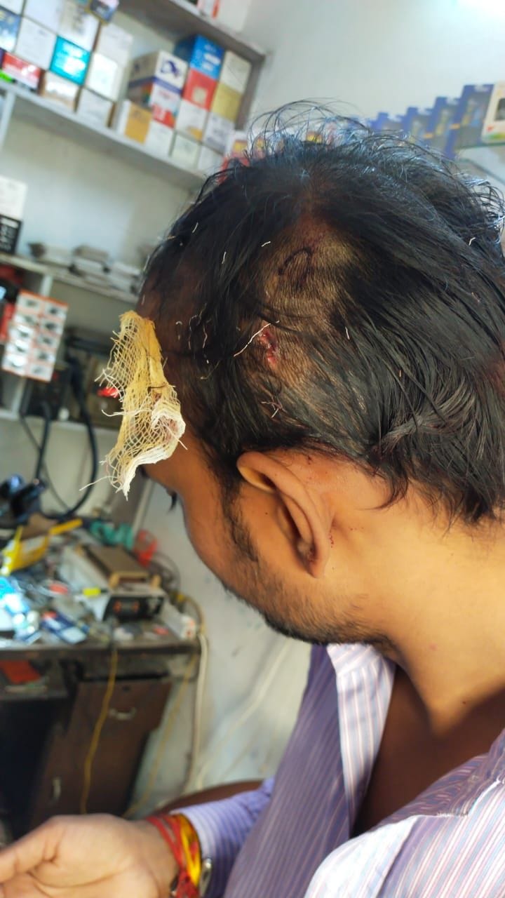 2 lakh 80 thousand rupees and mobile were looted by attacking the shopkeeper