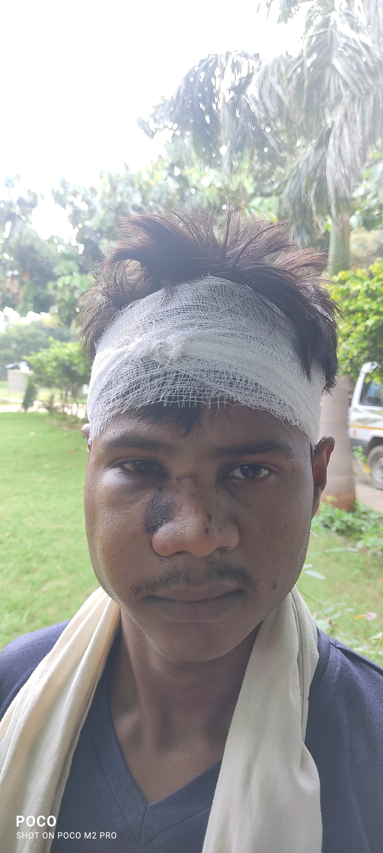 etawah news,Brother-in-law beat up brother who came to sister's in-laws' house