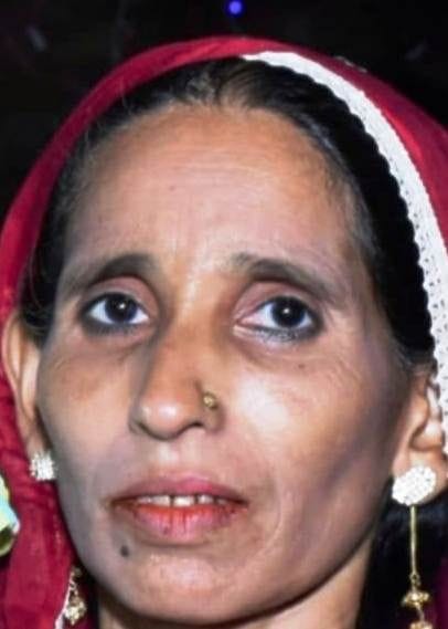 3 killed including Asha worker due to dengue