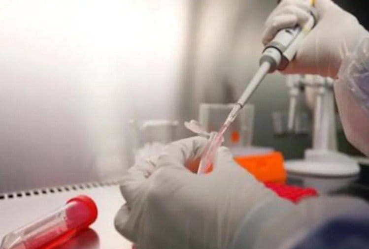 In a research of National institute of virology antibody against nipah virus founded in bats