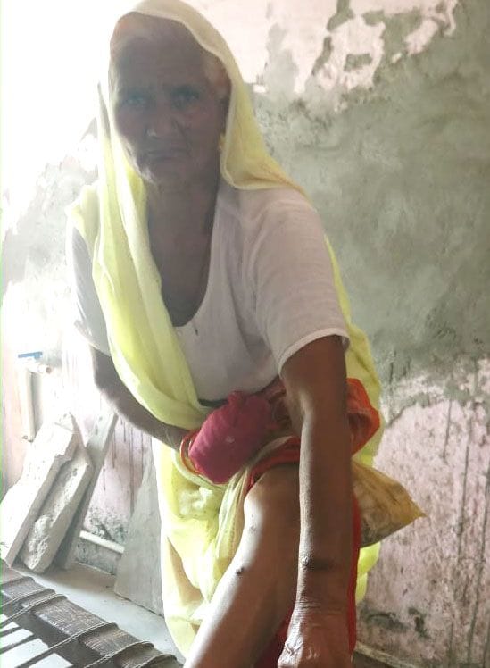 Monkeys in Bamnikheda have injured many people