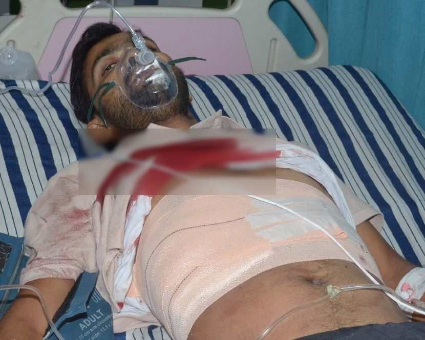 miscreant shot social worker in old enmity in varanasi