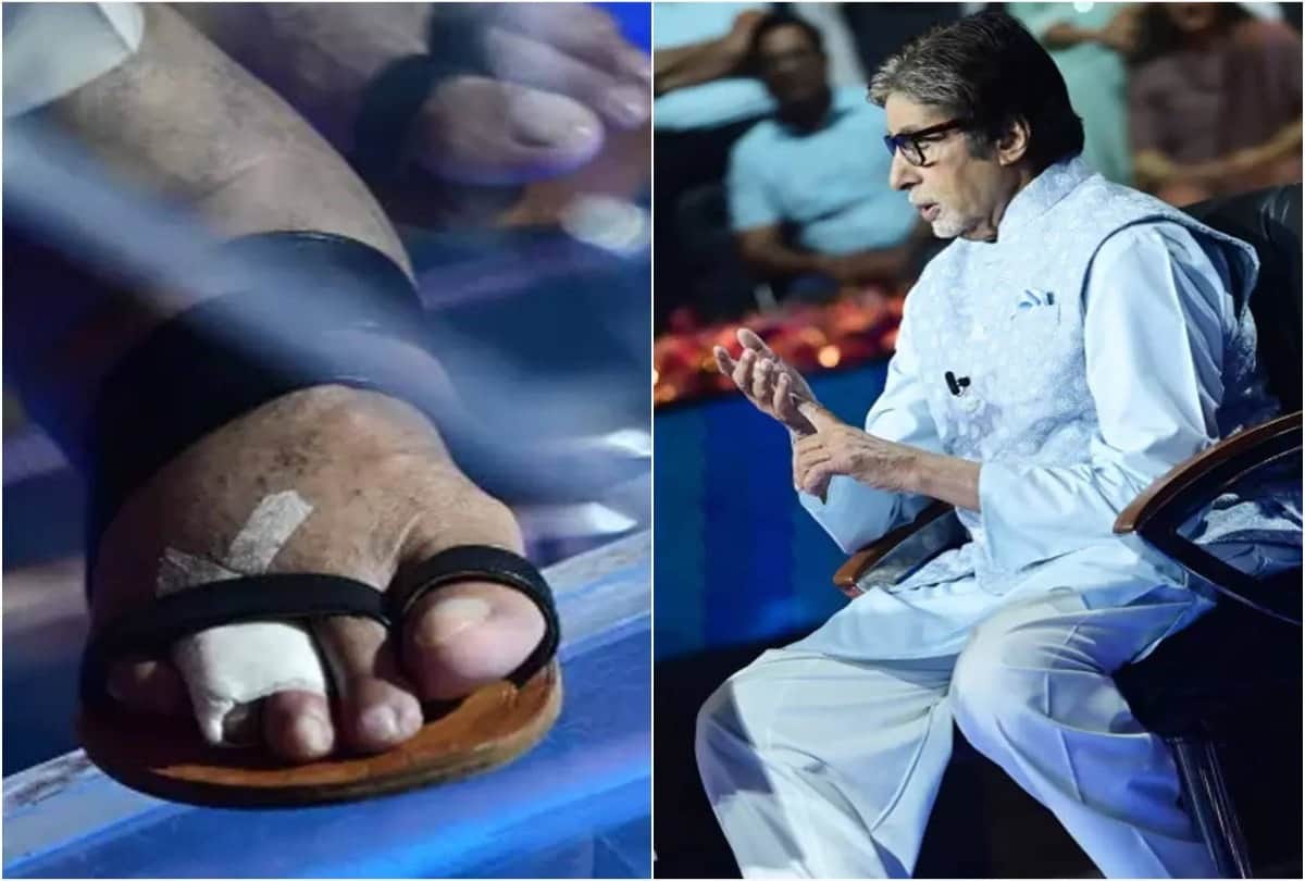 Amitabh Bachchan shooting for KBC even with injured thumb picture goes viral on social media