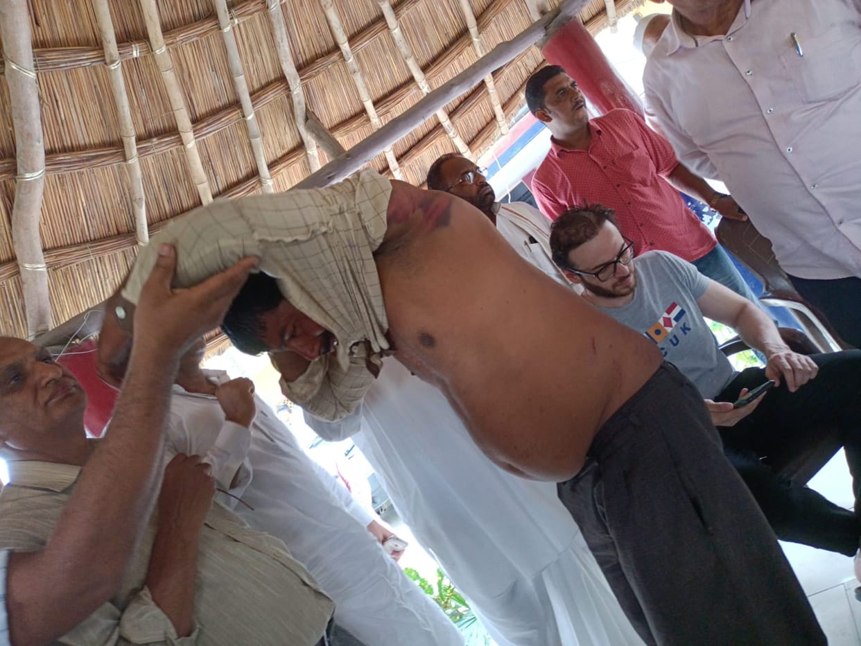 Forest workers beat up villager, uproar at police station