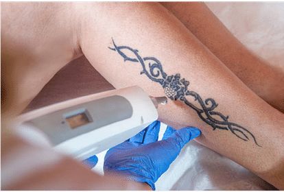 The hobby of tattooing can make patient of hepatitis
