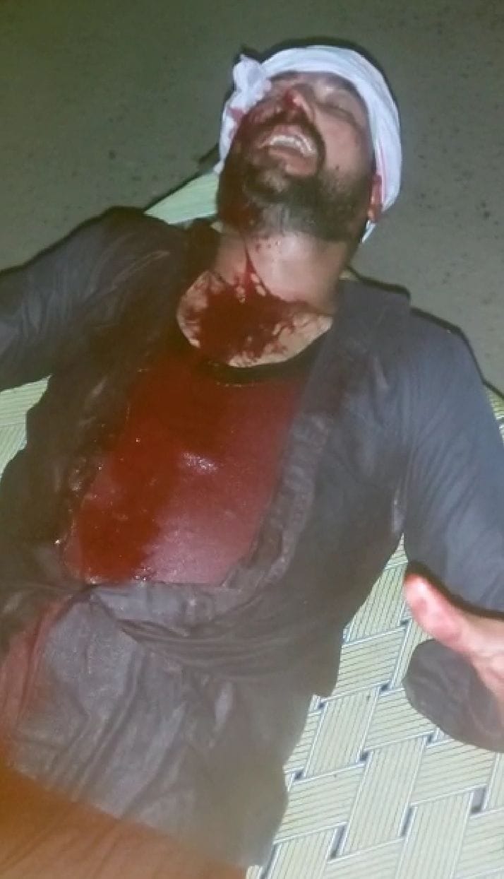 farmer attack in protest