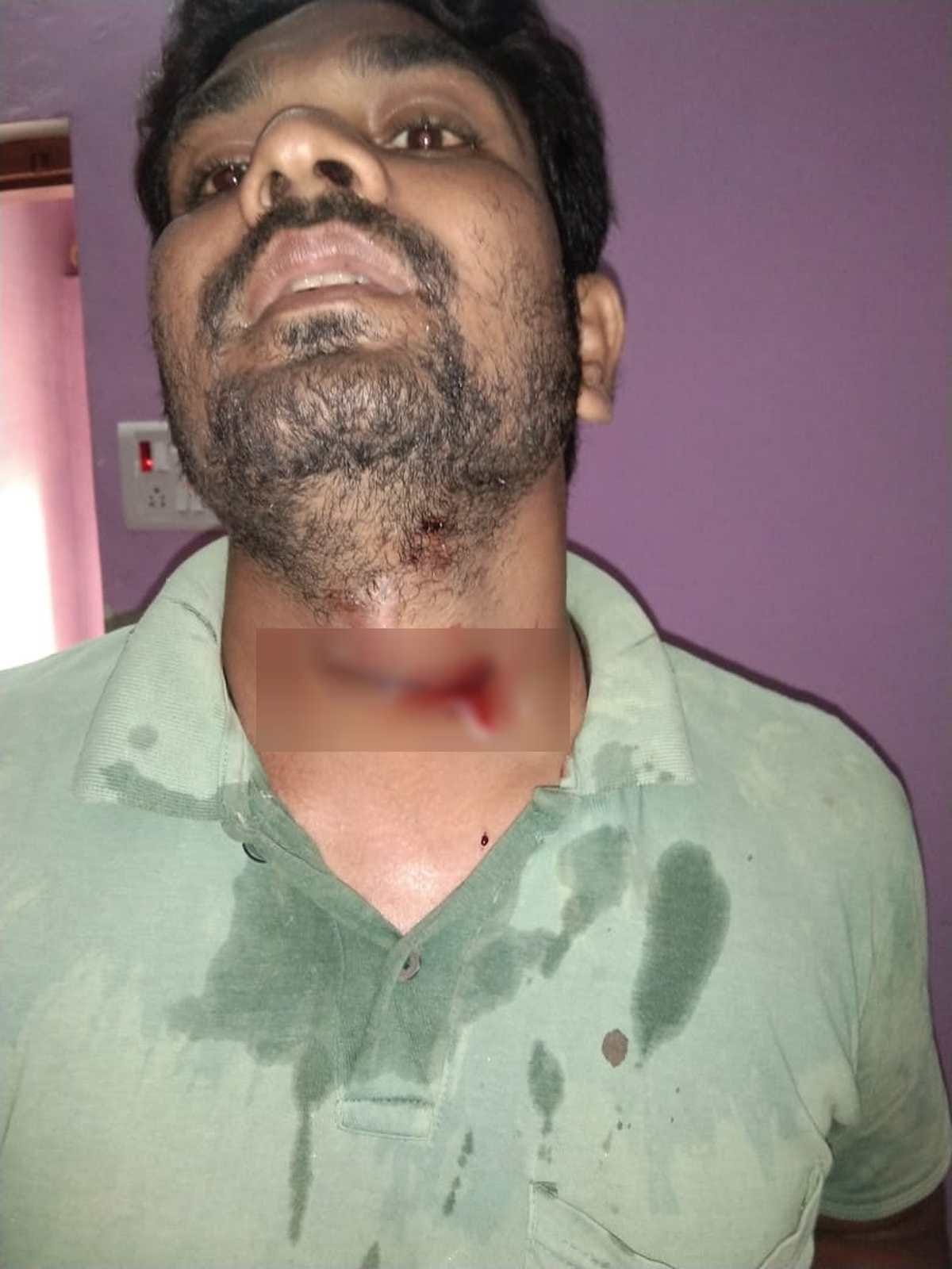 Bike rider throat slit by Chinese manja condition serious Varanasi