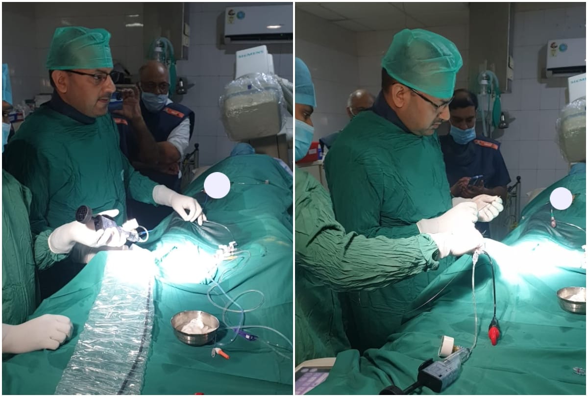 Heart Attack Patient Angioplasty Treatment With Intravascular Shock Wave Lithotripsy Save Live