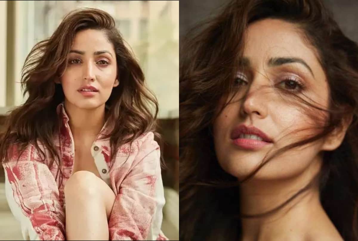 Yami Gautam opens up about her skin disease on Instagram
