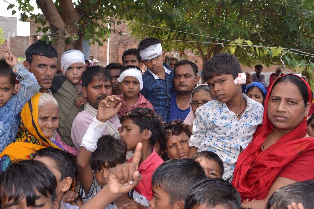 aligarh : monkey bite more than 50 children
