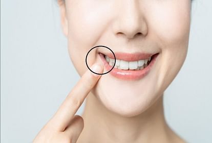 Home remedies to get rid cavities in teeth