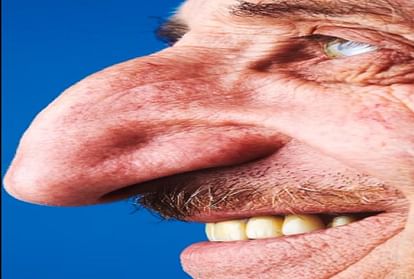 Worlds biggest nose Turkey man's nose is still growing very fast Thats why his name is enrolled in  guinness book of world record