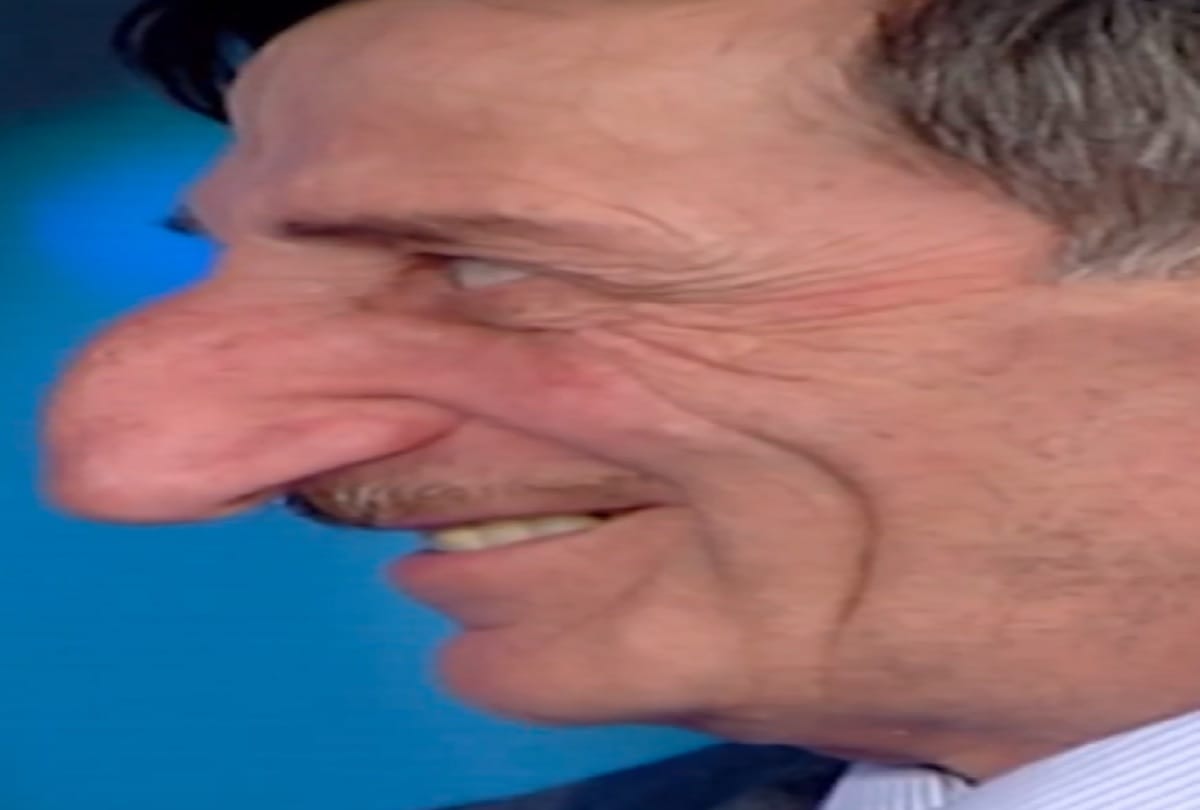 Worlds biggest nose Turkey man's nose is still growing very fast Thats why his name is enrolled in  guinness book of world record