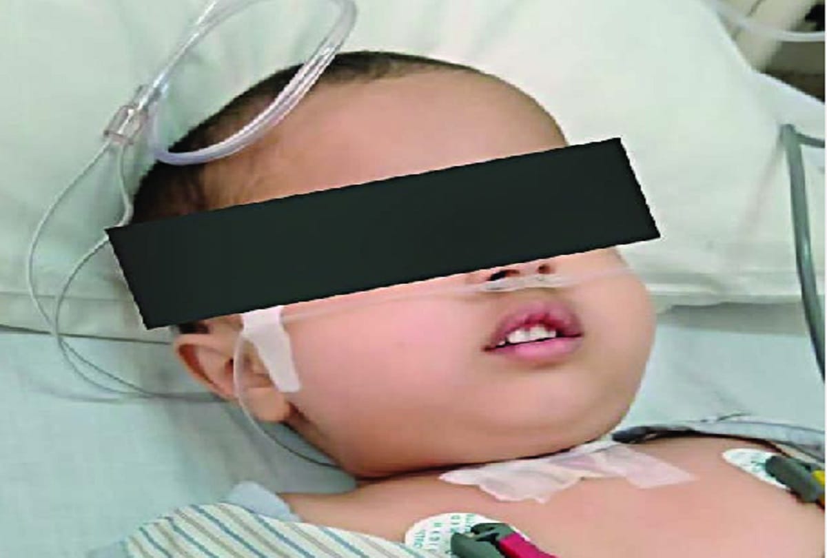 Delhi News :  A girl swallowed a pencil but doctors saved her life