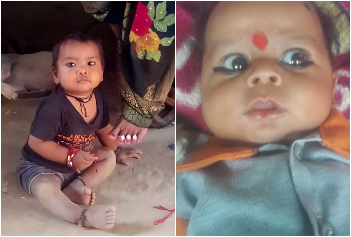 Agra Viral Fever Latest News: two children dies of fever in agra