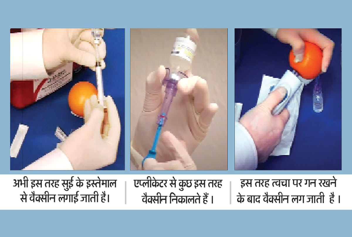 Technique: first DNA vaccine will be given at a speed of 200 meters per second with an injector gun, know how it works