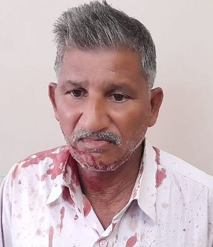 Bike rider dies after colliding with Kadipur bridge, relative serious