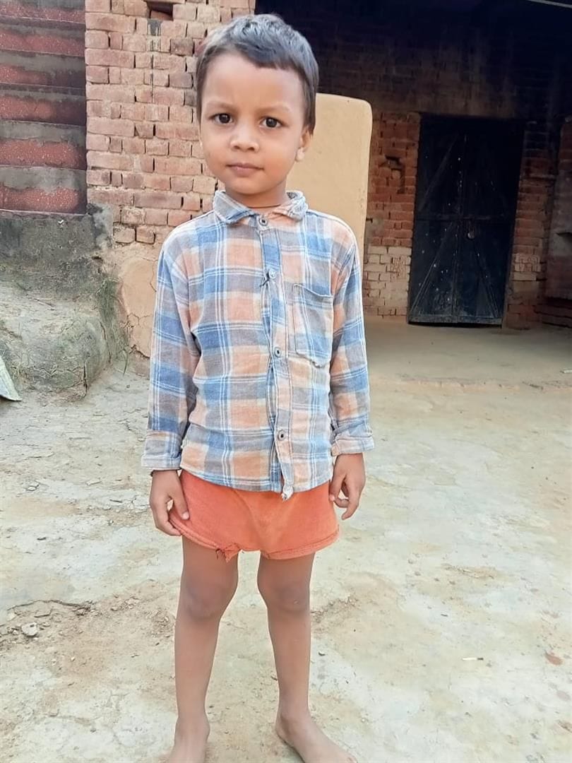 Hathras: Two brothers and sisters died of fever in Sadabad