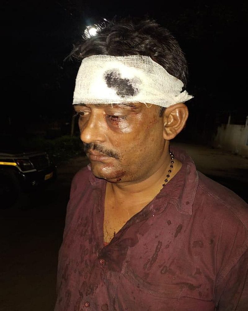 Attempted robbery with government advocate, injured by gunshot