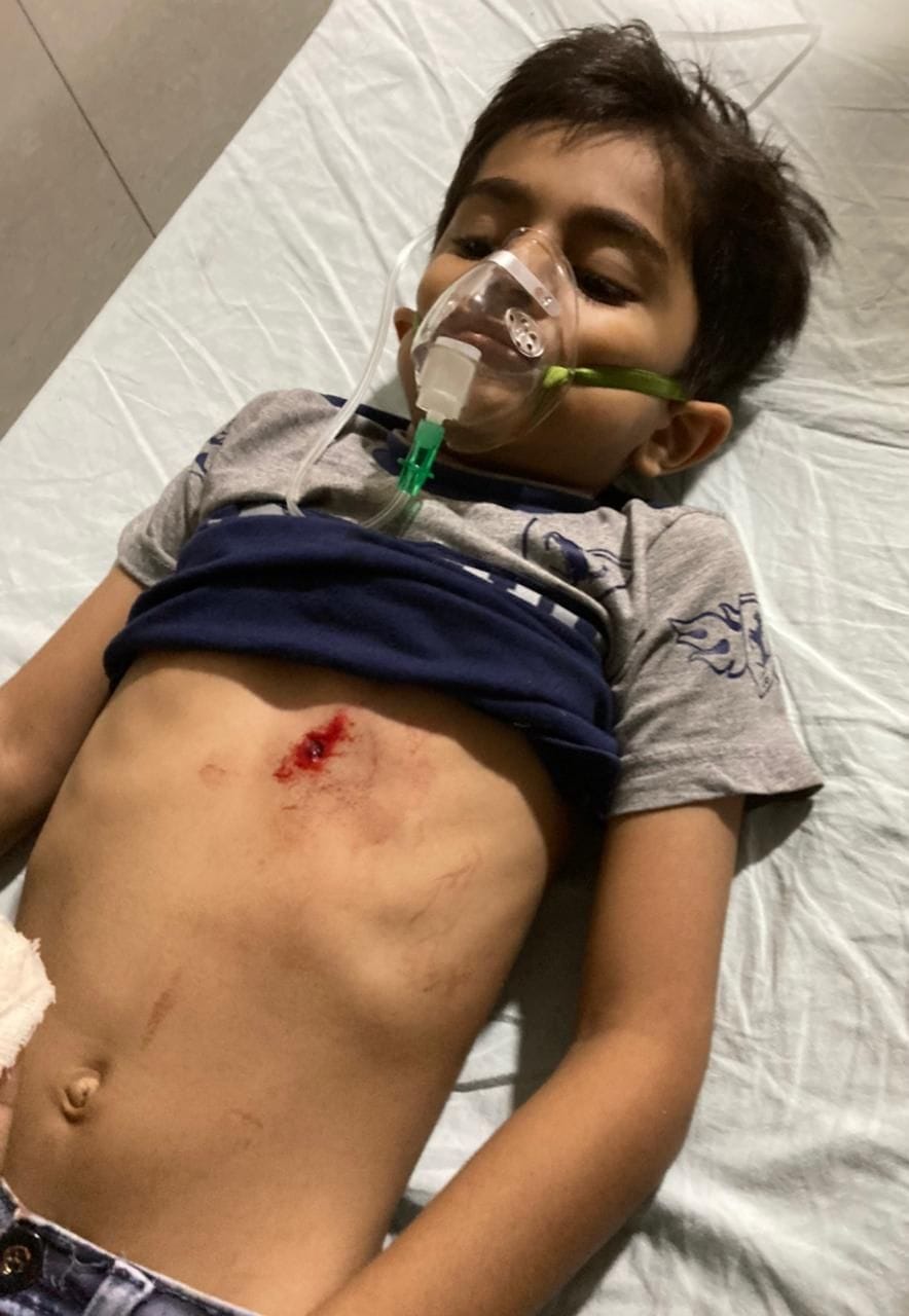 TV serial CID director's son shot