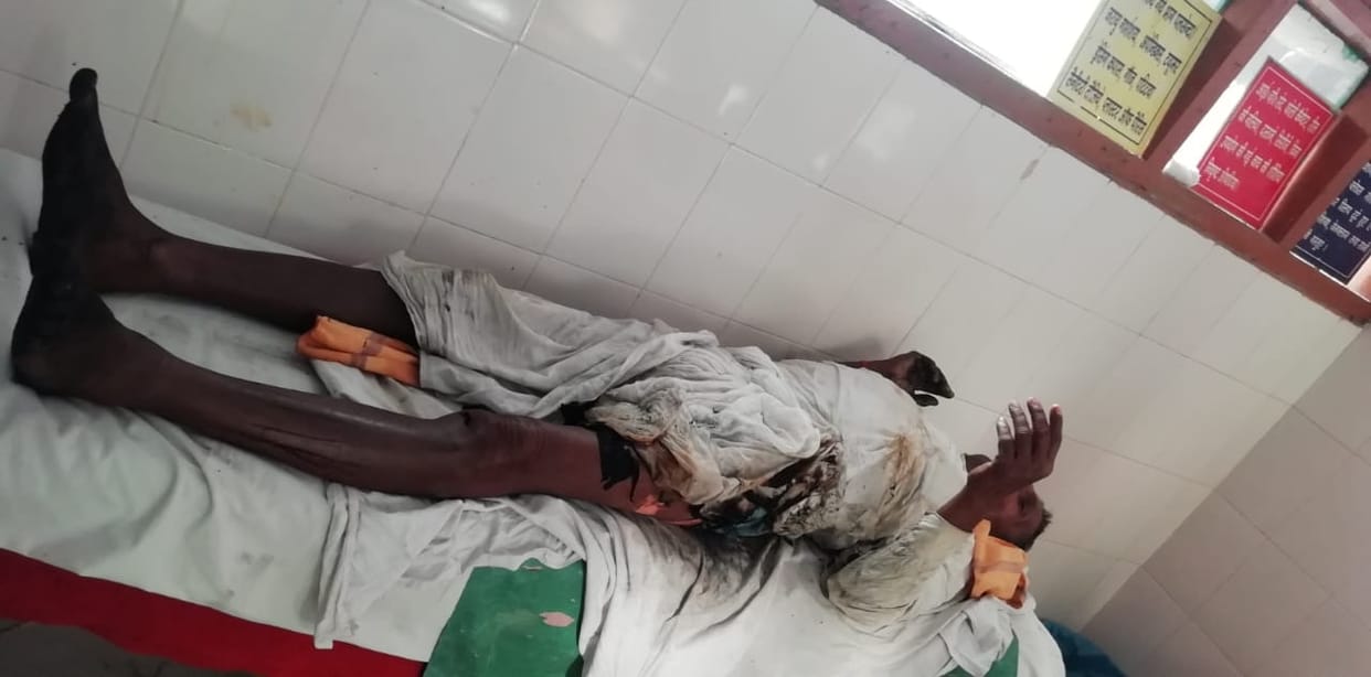 Devotees fell in the Havan Kund of Bajreshwari temple