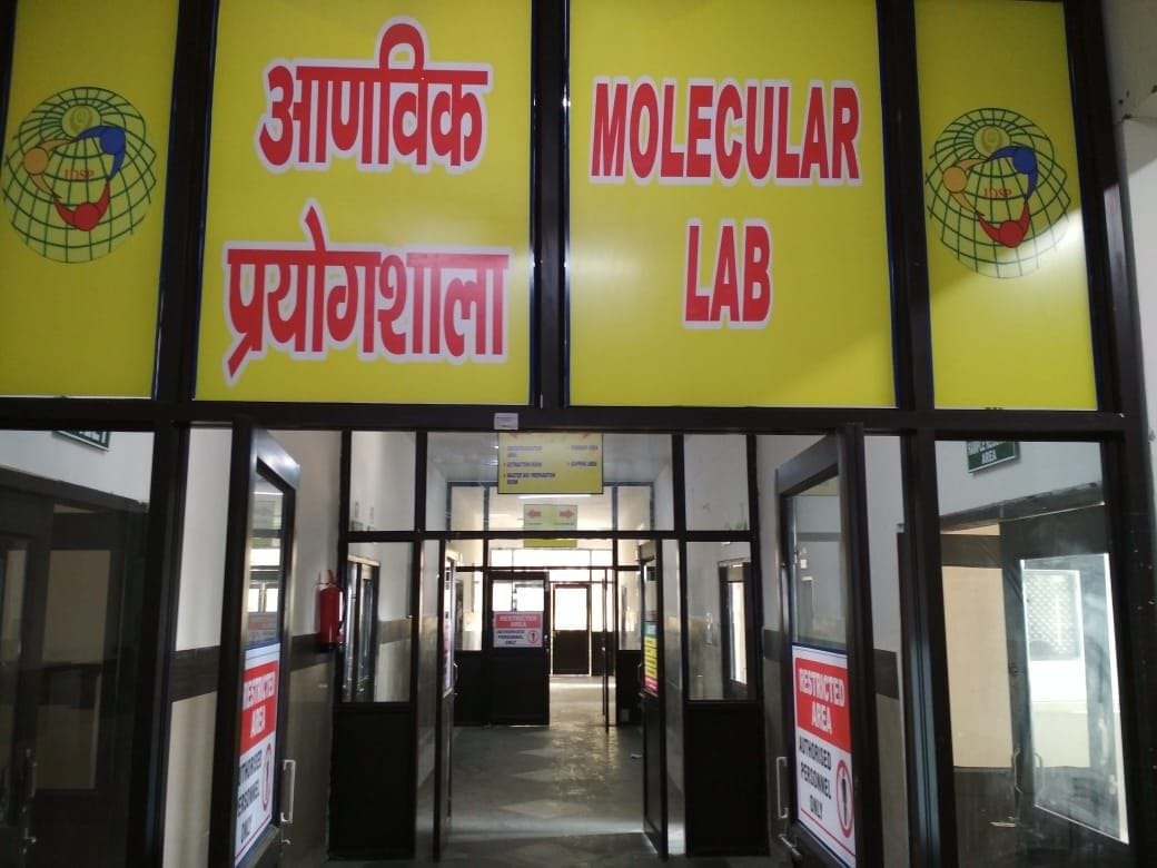 Hepatitis b and c test will be done in uchana govrmenet hospital