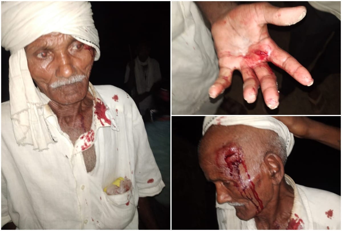 Pratapgarh: Five people including two women were shot in the fight in the election rivalry