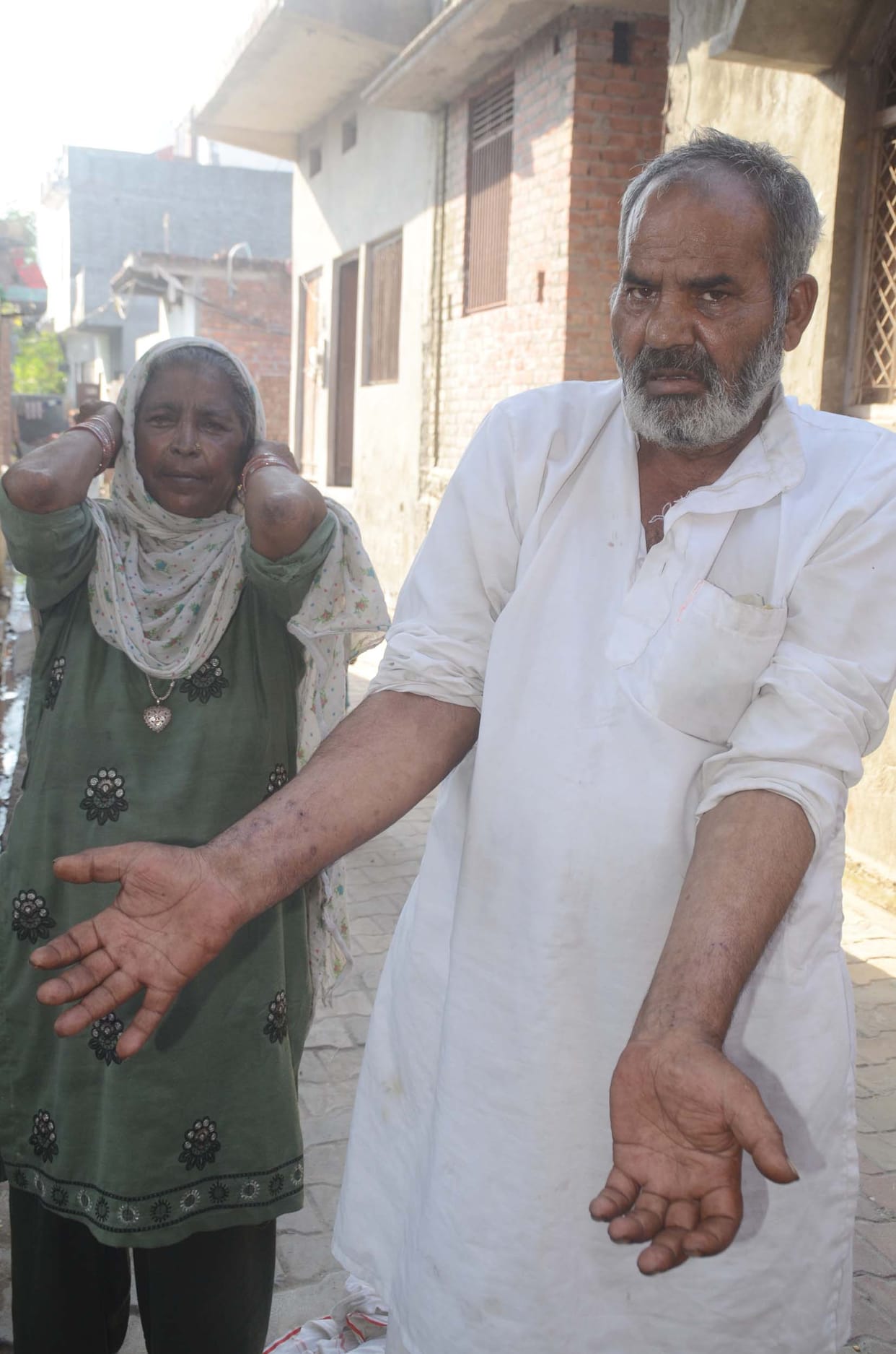 TDM of water reached one thousand, people started falling prey to diseases