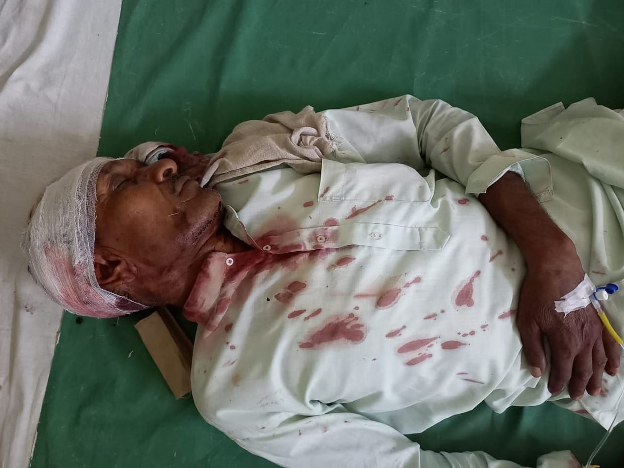 The old man going home by bike with the head was shot, referred