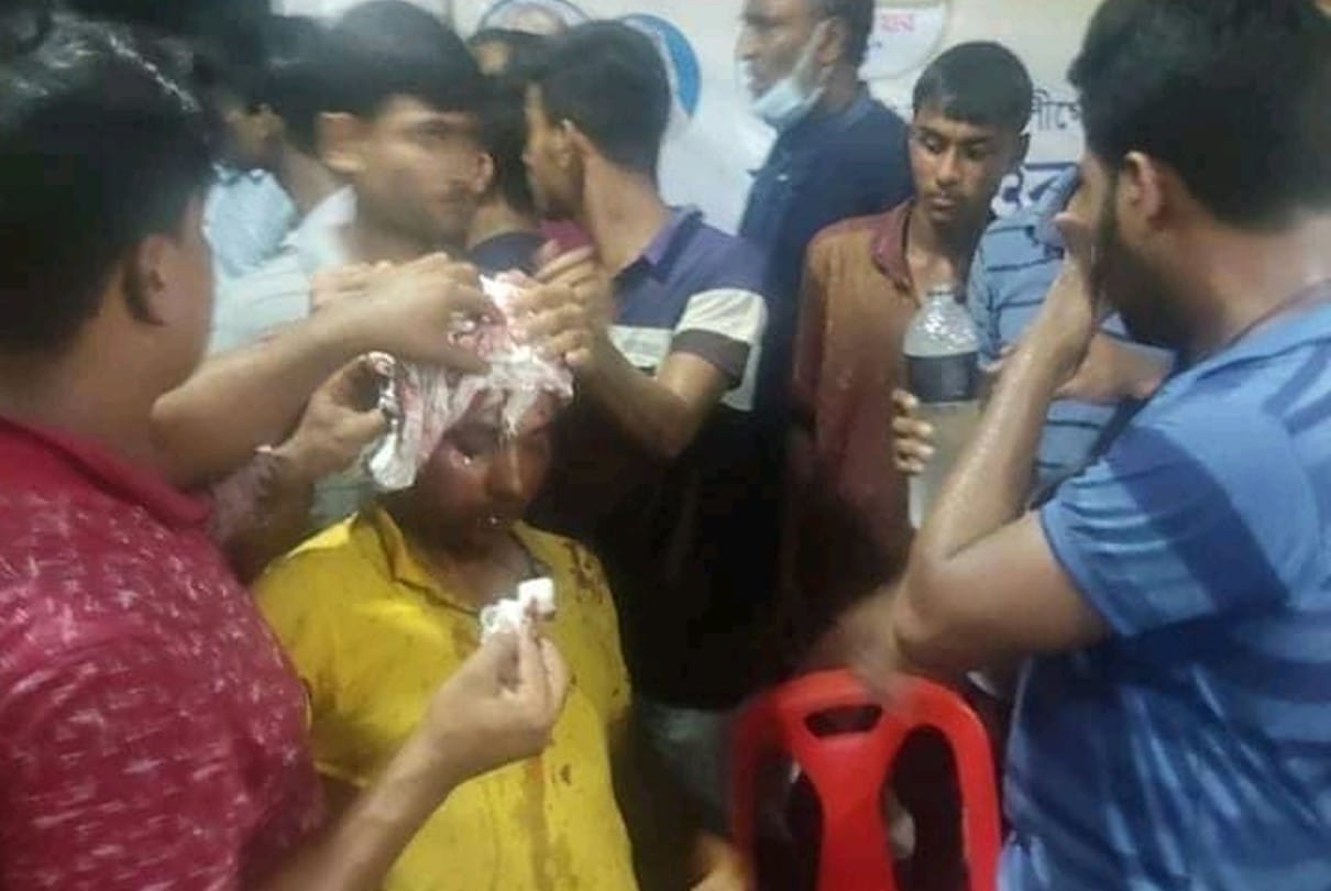 बांग्लादेश के इस्कॉन मंदिर में कट्टरपंथियों ने हमला कर दिया। इसमें कई हिंदुओं को बुरी तरह से चोट लगी है।