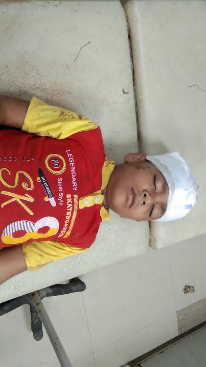 Uncontrollable car crossed the divider and collided with a bike and three wheeler in the second lane, six injured