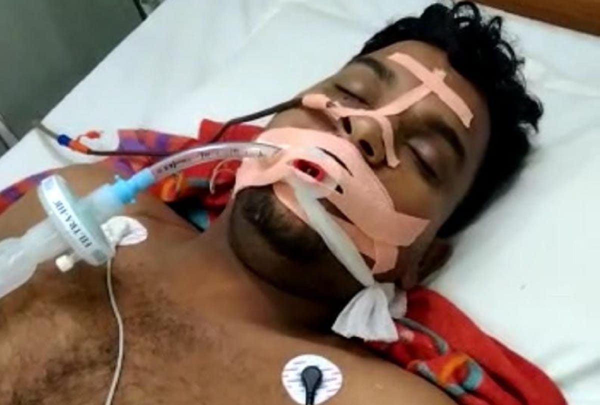 Pratapgarh: Two constables injured in firing on the police team that went to catch the miscreants