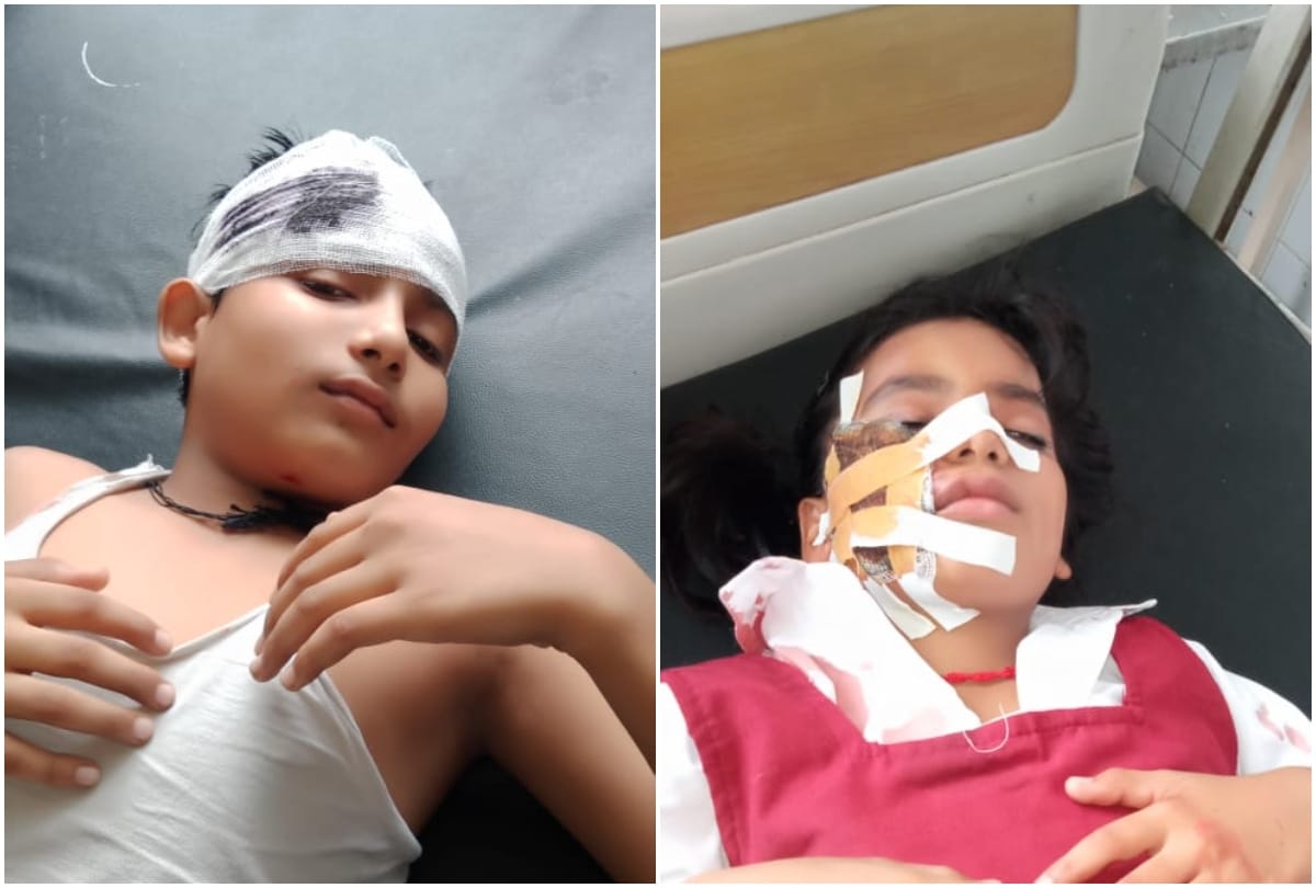 Raod accident in varanasi three school children including father injured after overspeed Auto hit bike in Ramnagar