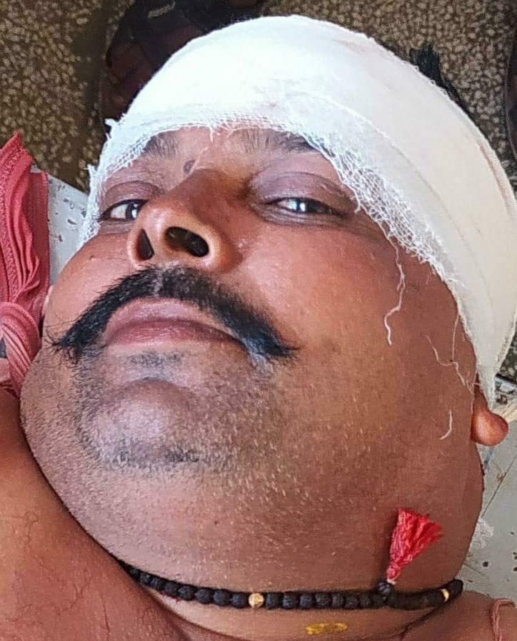 fathepur news,Knife attack on two youths coming by bike
