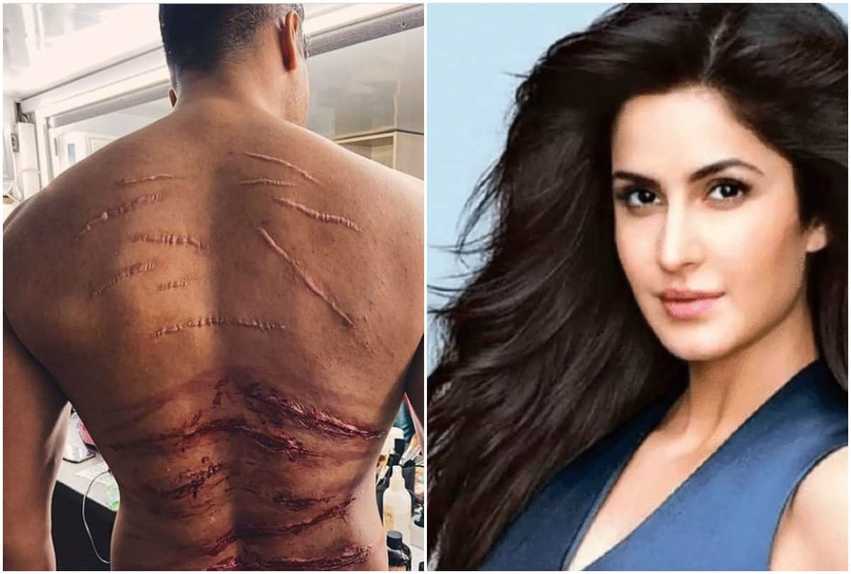 Vicky Kaushal shows prosthetic scars on back fan jokes Katrina ko dukh hoga