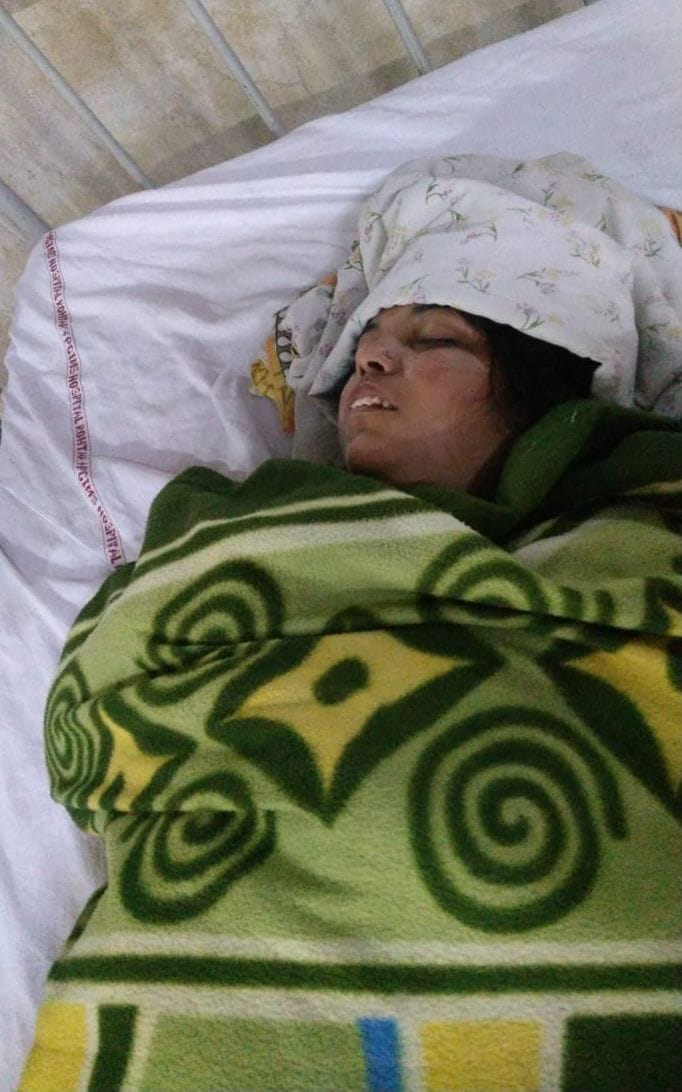 The mangalsutra of a woman riding a bike was snatched, the woman fell on the road due to shock, admitted to PGI
