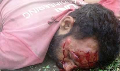 Youth seriously injured after being cut by Lucknow passenger