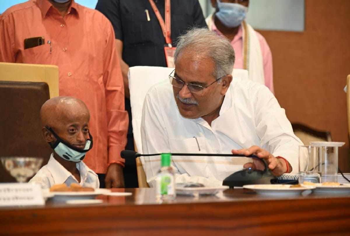 Chhattisgarh CM Bhupesh Baghel meets tribal boy suffering from progeria