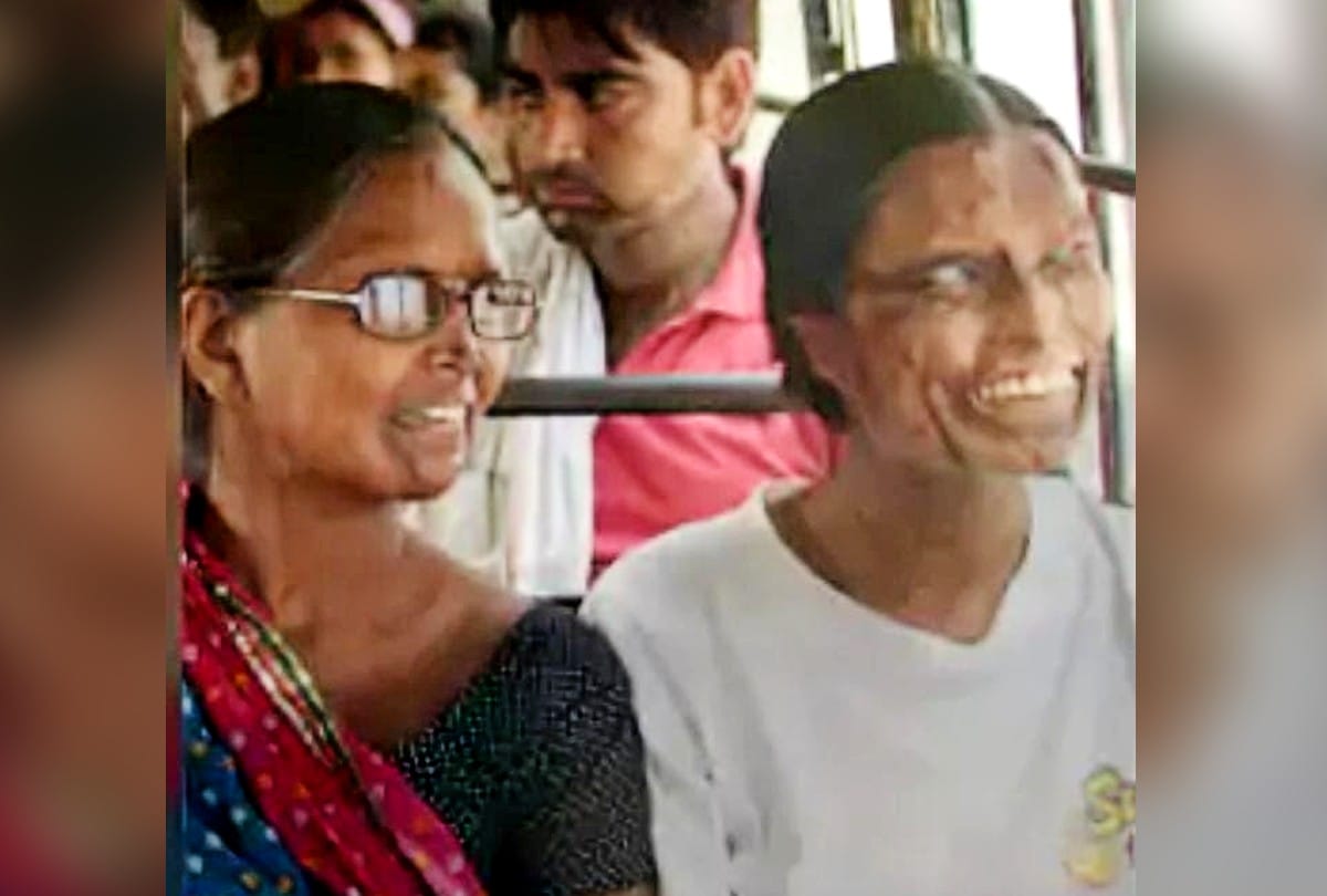 Agra Acid Attack Survivor Mother-Daughter Story Will Be Screened at Melbourne Film Festival